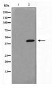HTR1A / 5-HT1A Receptor Antibody - Western blot of HepG2 cell lysate using 5-HT-1A Antibody