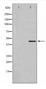 HTR1A / 5-HT1A Receptor Antibody - Western blot of 5-HT-1A expression in HepG2 cells