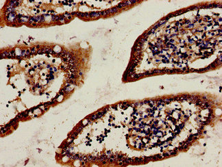 HTR1A / 5-HT1A Receptor Antibody - Immunohistochemistry analysis of human small intestine tissue at a dilution of 1:100