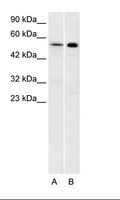 HTR1A / 5-HT1A Receptor Antibody - A: Daudi Cell Lysate, B: Raji Cell Lysate.  This image was taken for the unconjugated form of this product. Other forms have not been tested.