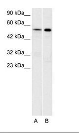 HTR1A / 5-HT1A Receptor Antibody - A: Daudi Cell Lysate, B: Raji Cell Lysate.  This image was taken for the unconjugated form of this product. Other forms have not been tested.