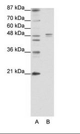 HTR1A / 5-HT1A Receptor Antibody - A: Marker, B: Jurkat Cell Lysate.  This image was taken for the unconjugated form of this product. Other forms have not been tested.