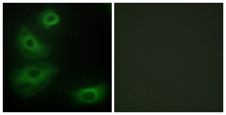 HTR1B / 5-HT1B Receptor Antibody - Immunofluorescence analysis of HeLa cells, using 5-HT-1B Antibody. The picture on the right is blocked with the synthesized peptide.