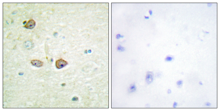 HTR1B / 5-HT1B Receptor Antibody - Immunohistochemistry analysis of paraffin-embedded human brain tissue, using 5-HT-1B Antibody. The picture on the right is blocked with the synthesized peptide.