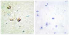 HTR1B / 5-HT1B Receptor Antibody - Immunohistochemistry analysis of paraffin-embedded human brain tissue, using 5-HT-1B Antibody. The picture on the right is blocked with the synthesized peptide.