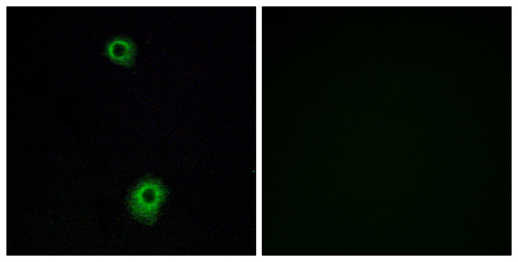 HTR1B / 5-HT1B Receptor Antibody - Immunofluorescence analysis of A549 cells, using HTR1B Antibody. The picture on the right is blocked with the synthesized peptide.