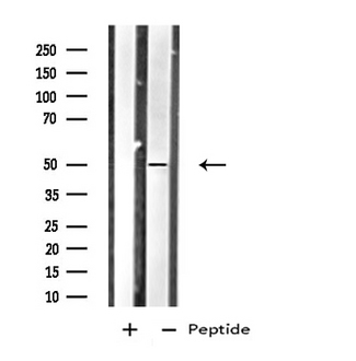 HTR1B / 5-HT1B Receptor Antibody - Western blot analysis of extracts of HepG2 cells using HTR1B antibody.