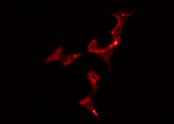 HTR1B / 5-HT1B Receptor Antibody - Staining HeLa cells by IF/ICC. The samples were fixed with PFA and permeabilized in 0.1% Triton X-100, then blocked in 10% serum for 45 min at 25°C. The primary antibody was diluted at 1:200 and incubated with the sample for 1 hour at 37°C. An Alexa Fluor 594 conjugated goat anti-rabbit IgG (H+L) Ab, diluted at 1/600, was used as the secondary antibody.