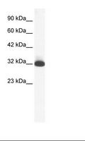 HTR1B / 5-HT1B Receptor Antibody - HepG2 Cell Lysate.  This image was taken for the unconjugated form of this product. Other forms have not been tested.