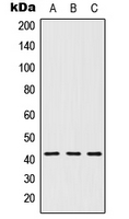 HTR1D / 5-HT1D Receptor Antibody - Western blot analysis of 5-HT1D expression in MCF7 (A); Raw264.7 (B); H9C2 (C) whole cell lysates.
