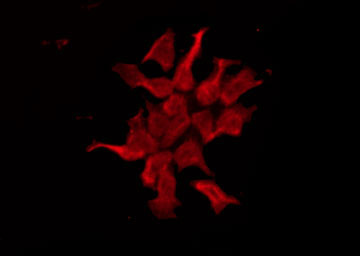 HTR1E / 5-HT1E Receptor Antibody - Staining HeLa cells by IF/ICC. The samples were fixed with PFA and permeabilized in 0.1% Triton X-100, then blocked in 10% serum for 45 min at 25°C. The primary antibody was diluted at 1:200 and incubated with the sample for 1 hour at 37°C. An Alexa Fluor 594 conjugated goat anti-rabbit IgG (H+L) Ab, diluted at 1/600, was used as the secondary antibody.