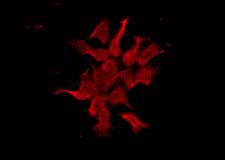 HTR1E / 5-HT1E Receptor Antibody - Staining HeLa cells by IF/ICC. The samples were fixed with PFA and permeabilized in 0.1% Triton X-100, then blocked in 10% serum for 45 min at 25°C. The primary antibody was diluted at 1:200 and incubated with the sample for 1 hour at 37°C. An Alexa Fluor 594 conjugated goat anti-rabbit IgG (H+L) Ab, diluted at 1/600, was used as the secondary antibody.