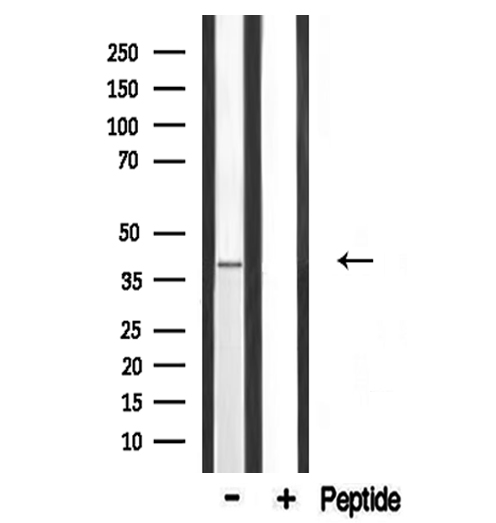 HTR1F / 5-HT1F Receptor Antibody - Western blot analysis of extracts of mouse lung using 5-HT-1F antibody.