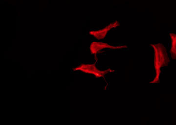HTR1F / 5-HT1F Receptor Antibody - Staining HeLa cells by IF/ICC. The samples were fixed with PFA and permeabilized in 0.1% Triton X-100, then blocked in 10% serum for 45 min at 25°C. The primary antibody was diluted at 1:200 and incubated with the sample for 1 hour at 37°C. An Alexa Fluor 594 conjugated goat anti-rabbit IgG (H+L) Ab, diluted at 1/600, was used as the secondary antibody.