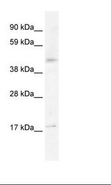 HTR1F / 5-HT1F Receptor Antibody - Fetal Liver Lysate.  This image was taken for the unconjugated form of this product. Other forms have not been tested.