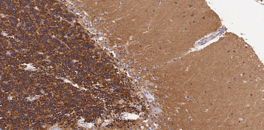 HTR2A / 5-HT2A Receptor Antibody - Staining of paraffin embedded Human Cerebellum. Microwaved antigen retrieval with citrate buffer pH 6, HRP-staining.