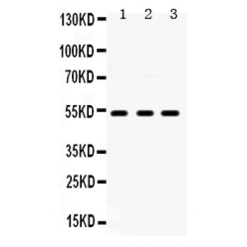 HTR2A / 5-HT2A Receptor Antibody - 5HT2A Receptor antibody Western blot. All lanes: Anti 5HT2A Receptor at 0.5 ug/ml. Lane 1: Rat Brain Tissue Lysate at 50 ug. Lane 2: Rat Testis Tissue Lysate at 50 ug. Lane 3: U87 Whole Cell Lysate at 40 ug. Predicted band size: 53 kD. Observed band size: 53 kD.