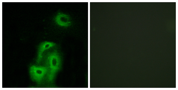 HTR2A / 5-HT2A Receptor Antibody - Immunofluorescence analysis of A549 cells, using 5-HT-2A Antibody. The picture on the right is blocked with the synthesized peptide.
