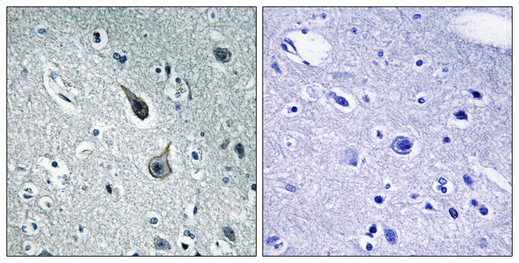 HTR2A / 5-HT2A Receptor Antibody - Immunohistochemistry analysis of paraffin-embedded human brain tissue, using 5-HT-2A Antibody. The picture on the right is blocked with the synthesized peptide.
