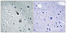 HTR2A / 5-HT2A Receptor Antibody - Immunohistochemistry analysis of paraffin-embedded human brain tissue, using 5-HT-2A Antibody. The picture on the right is blocked with the synthesized peptide.