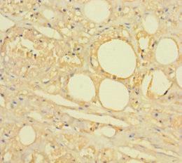HTR2A / 5-HT2A Receptor Antibody - Immunohistochemistry of paraffin-embedded human skin tissue using HTR2A Antibody at dilution of 1:100