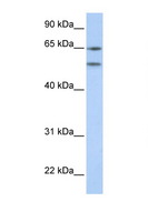 HTR2A / 5-HT2A Receptor Antibody - HTR2A / 5-HT2A antibody Western blot of 721_B Cell lysate. Antibody concentration 1 ug/ml. This image was taken for the unconjugated form of this product. Other forms have not been tested.
