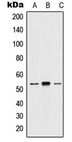 HTR2A / 5-HT2A Receptor Antibody - Western blot analysis of 5-HT2A expression in HEK293T (A); mouse brain (B); H9C2 (C) whole cell lysates.