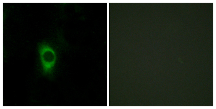 HTR2B / 5-HT2B Receptor Antibody - Immunofluorescence analysis of HeLa cells, using 5-HT-2B Antibody. The picture on the right is blocked with the synthesized peptide.