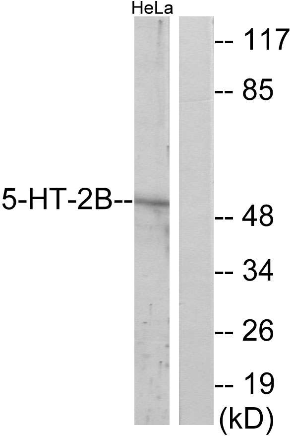HTR2B / 5-HT2B Receptor Antibody - Western blot analysis of lysates from HeLa cells, using 5-HT-2B Antibody. The lane on the right is blocked with the synthesized peptide.