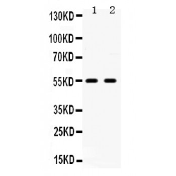 HTR2B / 5-HT2B Receptor Antibody - 5HT2B Receptor antibody Western blot. All lanes: Anti 5HT2B Receptor at 0.5 ug/ml. Lane 1: Rat Brain Tissue Lysate at 50 ug. Lane 2: U87 Whole Cell Lysate at 40 ug. Predicted band size: 54 kD. Observed band size: 54 kD.