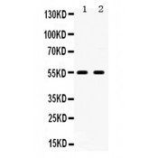 HTR2B / 5-HT2B Receptor Antibody - 5HT2B Receptor antibody Western blot. All lanes: Anti 5HT2B Receptor at 0.5 ug/ml. Lane 1: Rat Brain Tissue Lysate at 50 ug. Lane 2: U87 Whole Cell Lysate at 40 ug. Predicted band size: 54 kD. Observed band size: 54 kD.
