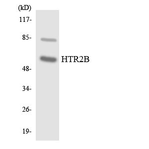 HTR2B / 5-HT2B Receptor Antibody - Western blot analysis of the lysates from COLO205 cells using HTR2B antibody.