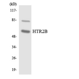 HTR2B / 5-HT2B Receptor Antibody - Western blot analysis of the lysates from COLO205 cells using HTR2B antibody.