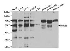 HTR2B / 5-HT2B Receptor Antibody - Western blot analysis of extracts of various cell lines, using HTR2B antibody.