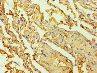 HTR2B / 5-HT2B Receptor Antibody - Immunohistochemistry of paraffin-embedded human lung at dilution 1:100