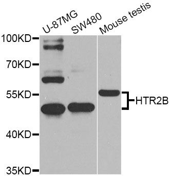 HTR2B / 5-HT2B Receptor Antibody - Western blot analysis of extracts of various cell lines, using HTR2B Antibody at 1:1000 dilution. The secondary antibody used was an HRP Goat Anti-Rabbit IgG (H+L) at 1:10000 dilution. Lysates were loaded 25ug per lane and 3% nonfat dry milk in TBST was used for blocking. An ECL Kit was used for detection and the exposure time was 5s.
