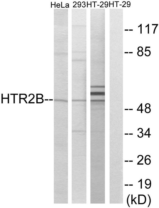 HTR2B / 5-HT2B Receptor Antibody - Western blot analysis of extracts from HeLa cells, 293 cells and HT-29 cells, using HTR2B antibody.