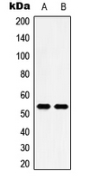 HTR2B / 5-HT2B Receptor Antibody - Western blot analysis of 5-HT2B expression in HeLa (A); HT29 (B) whole cell lysates.
