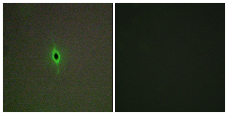 HTR2C / 5-HT2C Receptor Antibody - Immunofluorescence analysis of A549 cells, using 5-HT-2C Antibody. The picture on the right is blocked with the synthesized peptide.