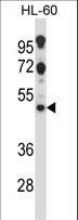 HTR2C / 5-HT2C Receptor Antibody - HTR2C Antibody western blot of HL-60 cell line lysates (35 ug/lane). The HTR2C antibody detected the HTR2C protein (arrow).