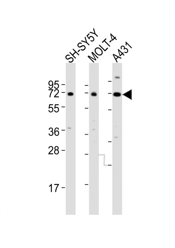 HTR2C / 5-HT2C Receptor Antibody - All lanes : Anti-HTR2C Antibody at 1:4000 dilution Lane 1: SH-SY5Y whole cell lysates Lane 2: MOLT-4 whole cell lysates Lane 3: A431 whole cell lysates Lysates/proteins at 20 ug per lane. Secondary Goat Anti-Rabbit IgG, (H+L), Peroxidase conjugated at 1/10000 dilution Predicted band size : 52 kDa Blocking/Dilution buffer: 5% NFDM/TBST.