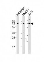 HTR2C / 5-HT2C Receptor Antibody - All lanes : Anti-HTR2C Antibody at 1:4000 dilution Lane 1: SH-SY5Y whole cell lysates Lane 2: MOLT-4 whole cell lysates Lane 3: A431 whole cell lysates Lysates/proteins at 20 ug per lane. Secondary Goat Anti-Rabbit IgG, (H+L), Peroxidase conjugated at 1/10000 dilution Predicted band size : 52 kDa Blocking/Dilution buffer: 5% NFDM/TBST.
