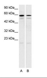 HTR2C / 5-HT2C Receptor Antibody - A: Daudi Cell Lysate, B: Raji Cell Lysate.  This image was taken for the unconjugated form of this product. Other forms have not been tested.