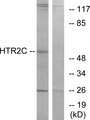 HTR2C / 5-HT2C Receptor Antibody - Western blot analysis of lysates from Jurkat cells, using HTR2C Antibody. The lane on the right is blocked with the synthesized peptide.