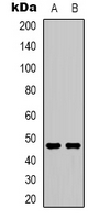 HTR2C / 5-HT2C Receptor Antibody - Western blot analysis of 5-HT2C expression in SHSY5Y (A); NIH3T3 (B) whole cell lysates.