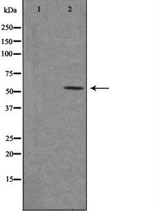 HTR2C / 5-HT2C Receptor Antibody - Western blot analysis of extracts of rat brain cells using 5-HT-2C antibody. The lane on the left is treated with the antigen-specific peptide.
