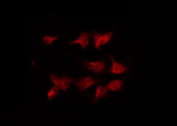 HTR2C / 5-HT2C Receptor Antibody - Staining HeLa cells by IF/ICC. The samples were fixed with PFA and permeabilized in 0.1% Triton X-100, then blocked in 10% serum for 45 min at 25°C. The primary antibody was diluted at 1:200 and incubated with the sample for 1 hour at 37°C. An Alexa Fluor 594 conjugated goat anti-rabbit IgG (H+L) Ab, diluted at 1/600, was used as the secondary antibody.