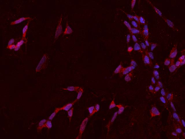HTR2C / 5-HT2C Receptor Antibody - Immunofluorescence staining of HTR2C in SHSY5Y cells. Cells were fixed with 4% PFA, permeabilzed with 0.1% Triton X-100 in PBS, blocked with 10% serum, and incubated with rabbit anti-Human HTR2C polyclonal antibody (dilution ratio 1:200) at 4°C overnight. Then cells were stained with the Alexa Fluor 594-conjugated Goat Anti-rabbit IgG secondary antibody (red) and counterstained with DAPI (blue). Positive staining was localized to Cytoplasm.