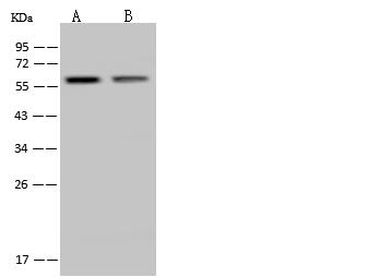 HTR2C / 5-HT2C Receptor Antibody - Anti-HTR2C rabbit polyclonal antibody at 1:500 dilution. Lane A: BxPC-3 Whole Cell Lysate. Lane B: MOLT-4 Whole Cell Lysate. Lysates/proteins at 30 ug per lane. Secondary: Goat Anti-Rabbit IgG (H+L)/HRP at 1/10000 dilution. Developed using the ECL technique. Performed under reducing conditions. Predicted band size: 52 kDa. Observed band size: 57 kDa.