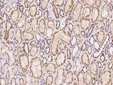 HTR2C / 5-HT2C Receptor Antibody - Immunochemical staining of human HTR2C in human kidney with rabbit polyclonal antibody at 1:100 dilution, formalin-fixed paraffin embedded sections.